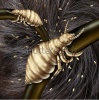 stock-photo-lice-in-hair-problem-as-a-medical-concept-with-a-macro-close-up-of-a-human-head-with-an-infe